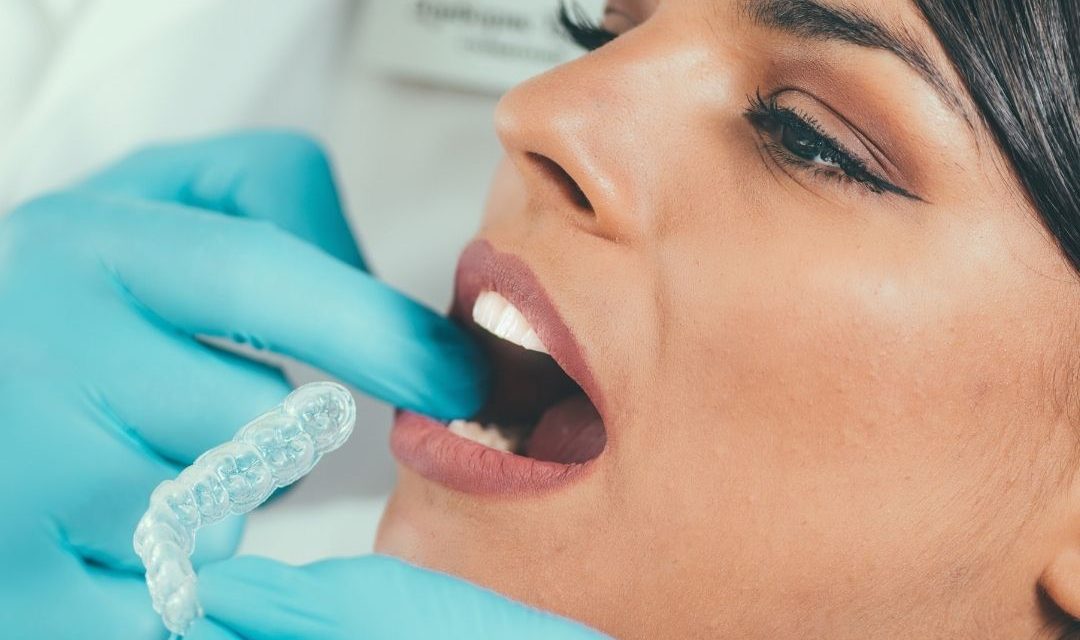Consejos para ayudarte con tu tratamiento invisalign