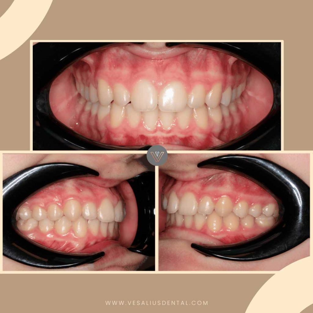 ortodoncia-tratamiento