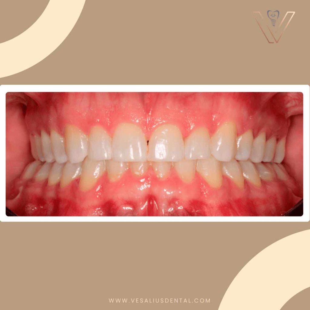 tratamiento-ortodoncia